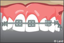 Orthodontie